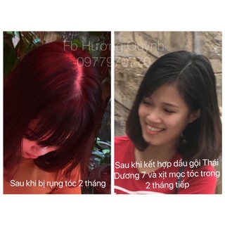 Xịt tóc mọc tóc dược liệu Thái Dương