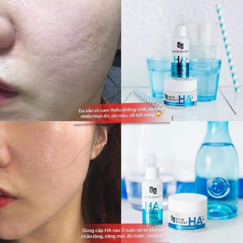 🔥MỸ PHẨM CHÂU ÂU CHÍNH HÃNG 🔥Sữa rửa mặt AA COSMETICS⚡ kiềm dầu ⚡ ngừa mụn⚡ mềm mịn ⚡ sạch sâu⚡ không hóa chất⚡ 150ml. 🔥