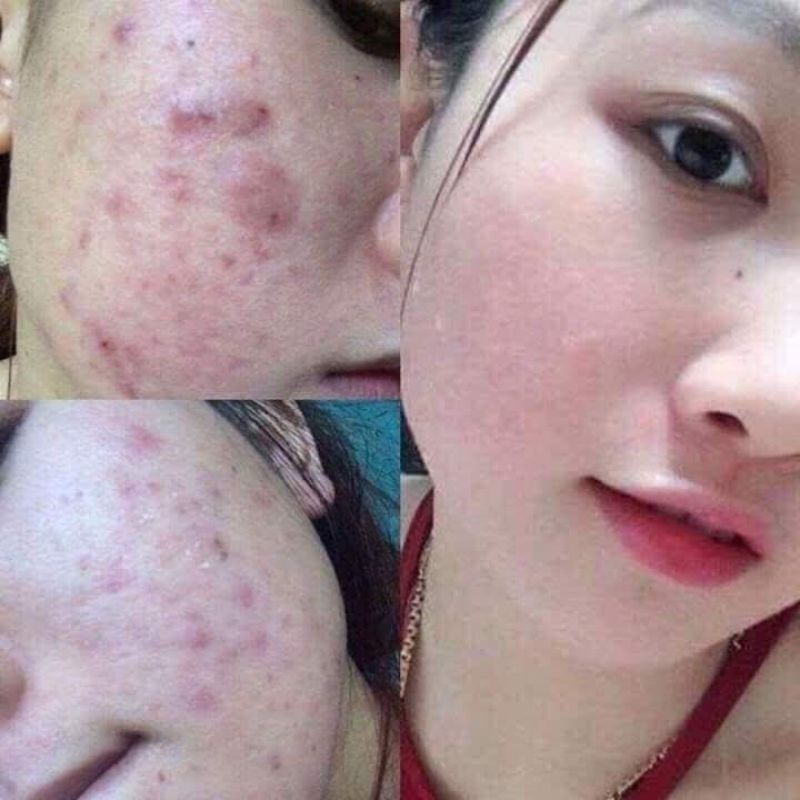 Đông Y Mộc Nhân Tái Tạo Da Thiên Nhiên Lọ 100ml