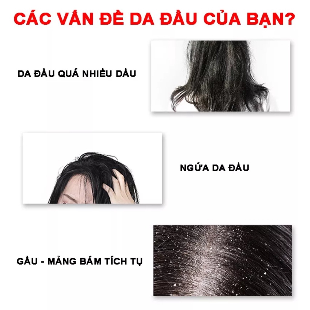 Tẩy Tế Bào Chết Cho Tóc & Da Đầu Jiorniee Hũ 250g - Sạch Gàu Kiềm Soát Dầu Thừa Tóc Không Còn Bết Dính