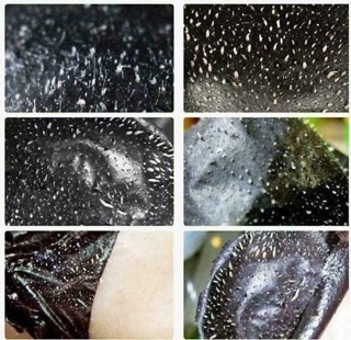 [CÓ SẴN] Gel Lột Mụn Remover