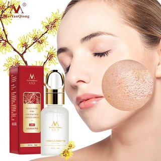 Serum Hết Mụn Se Khích Lỗ Chân Lông Trắng Da