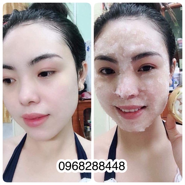 Mặt nạ yến vichy