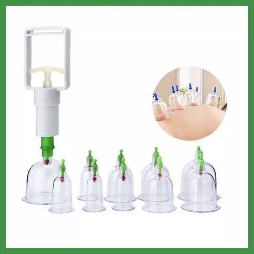 Bộ Giác Hơi 12 Ống Không Dùng Lửa An Toàn Tiện Dụng