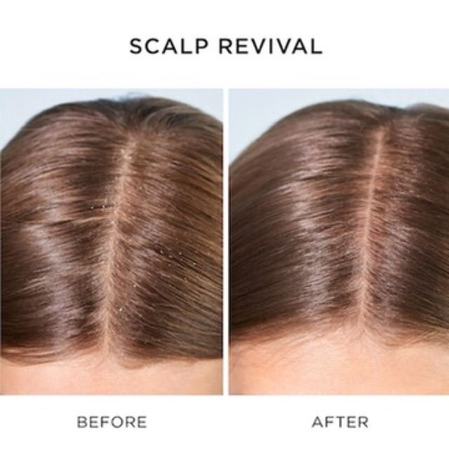 Dầu gội tẩy tế bào chết tóc Briogeo Scalp Revival™ Charcoal + Coconut Oil Micro-Exfoliating Shampoof