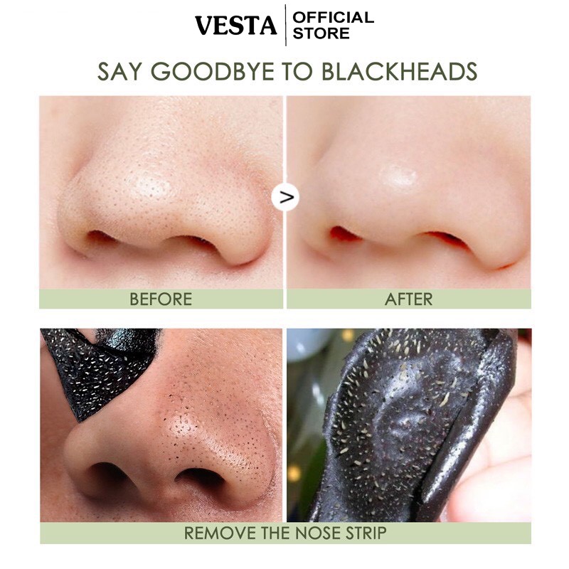 Miếng Dán Lột Mụn ☘BLACKHEADS☘ Lột Mụn Đầu Đen Làm Sạch Sâu Cho Vùng Mũi 2,2g | BigBuy360 - bigbuy360.vn