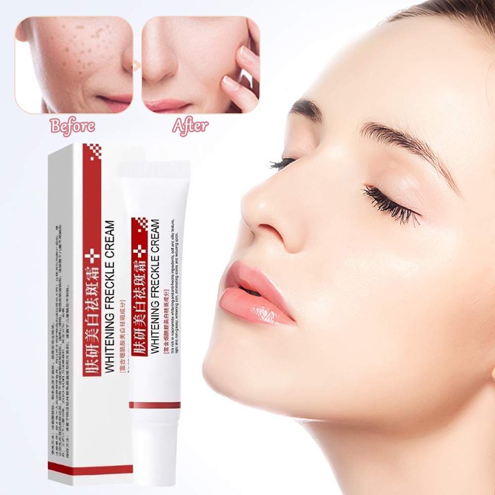 Kem dưỡng trắng da hỗ trợ giảm tàn nhang và đốm đen hiệu quả | BigBuy360 - bigbuy360.vn