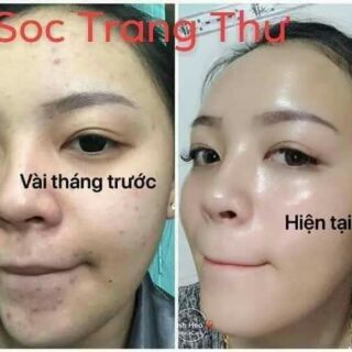 SỮA ONG CHÚA TƯƠI TRANG THƯ