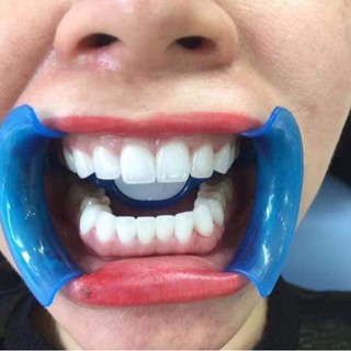 Hàm trainer chỉnh nha