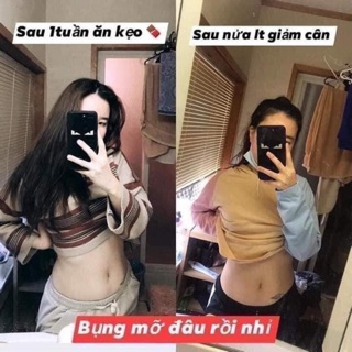 KẸO GIẢM CÂN SOCOLA ĐAN MẠCH[ TÁCH LẺ 20V ]