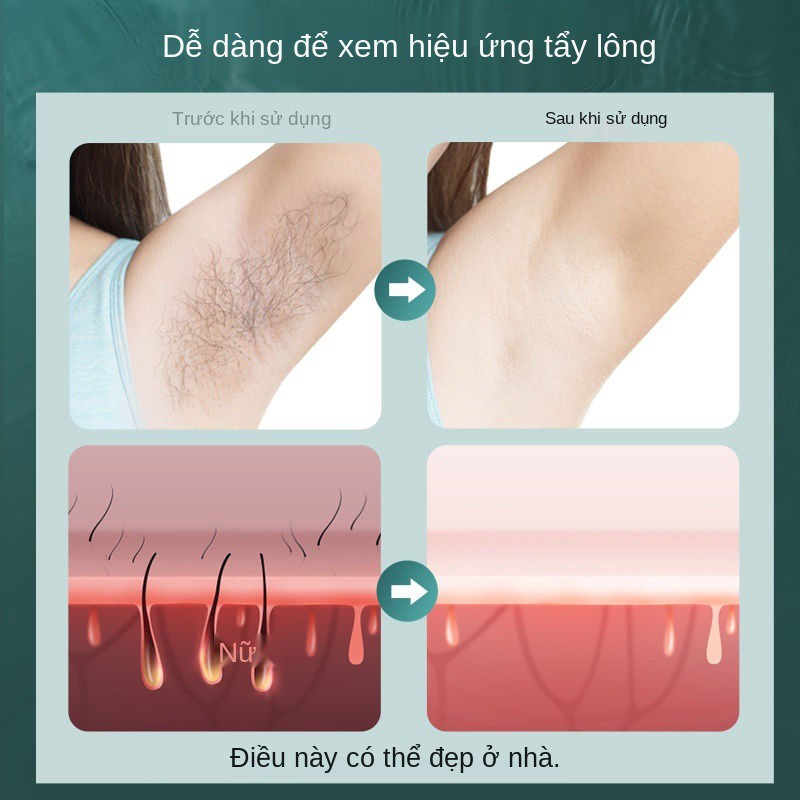 Thiết bị tẩy lông bằng laser điểm đông lạnh dùng trong gia đình để loại bỏ môi, vùng kín , mặt và nách. Tạo tác