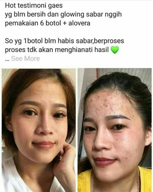 Xịt làm đẹp Natura 100% NaturaWorld chất lượng cao | BigBuy360 - bigbuy360.vn