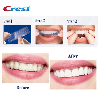 Miếng dán trắng răng Crest 3D White Whitestrips