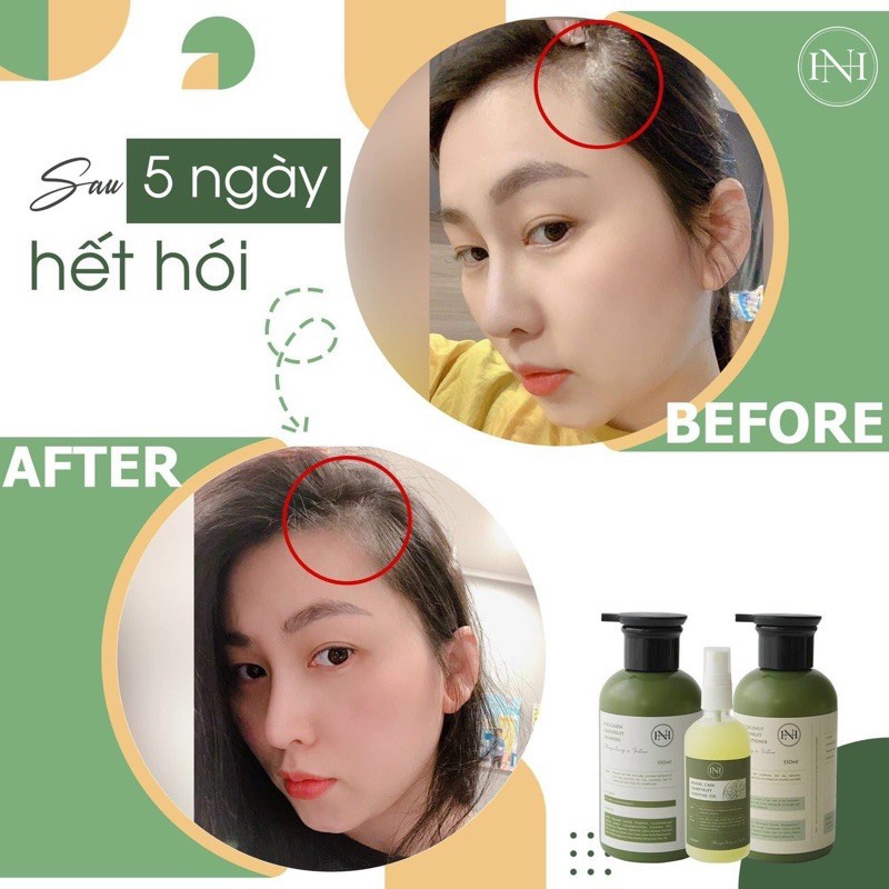 COMBO DÂU GÔI BƯỞI+TINH DÂU BƯỞI +GEL Ủ NGA HOÀNG (Chuẩn hãng) | BigBuy360 - bigbuy360.vn