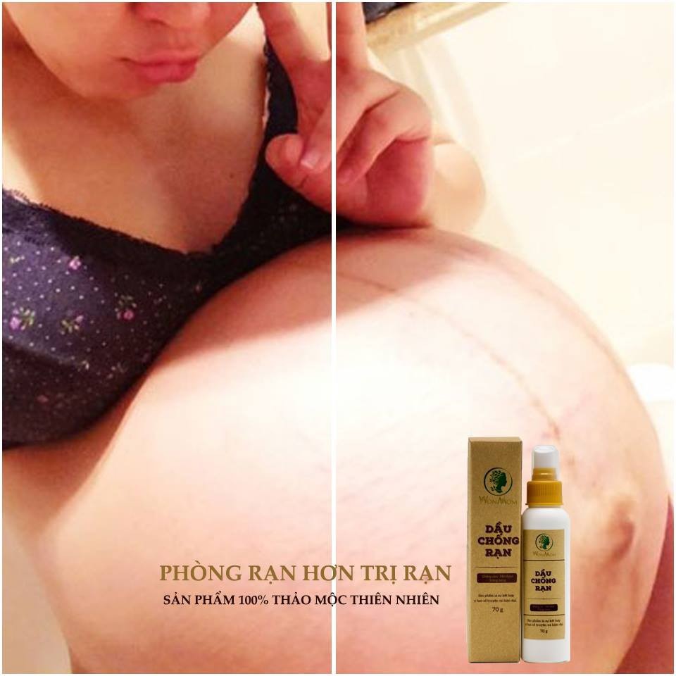 Dầu chống rạn da, dưỡng ẩm, dưỡng sáng da 70gr - WonMom (Việt Nam) | BigBuy360 - bigbuy360.vn