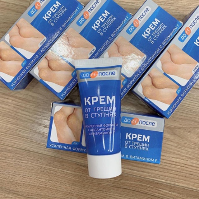 Kem Ngăn Ngừa Và Hồi Phục Nứt Nẻ Gót Chân Kpem Nga 50ml