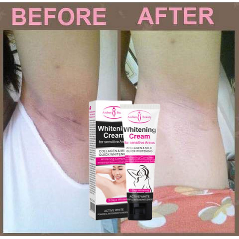 Kem Làm Trắng Vùng Da Dưới Cánh Tay / Đầu Gối / Vùng Kín M5-SI