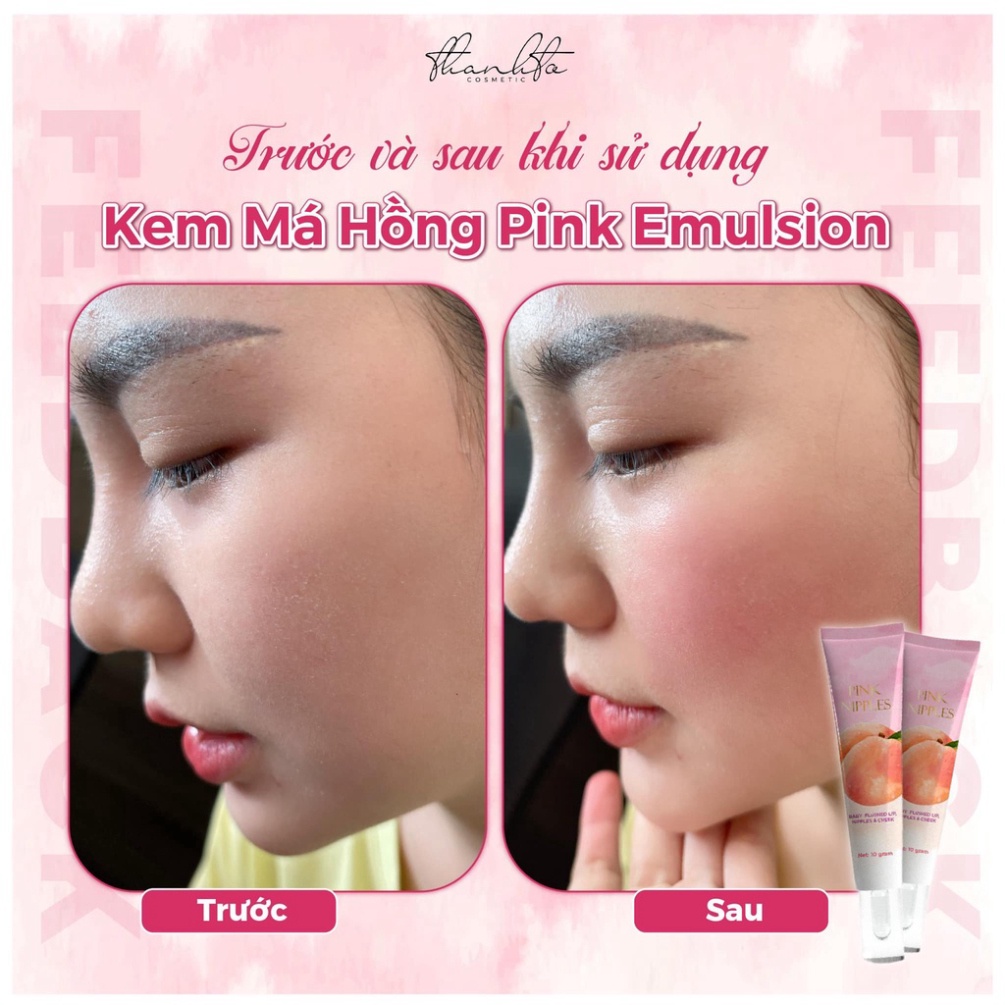 Kem Dưỡng Má Hồng - Pink Emulsion, Dưỡng má hồng từ nhiên, cấp ẩm da mịn mượt, tăng sinh collagen, Aco