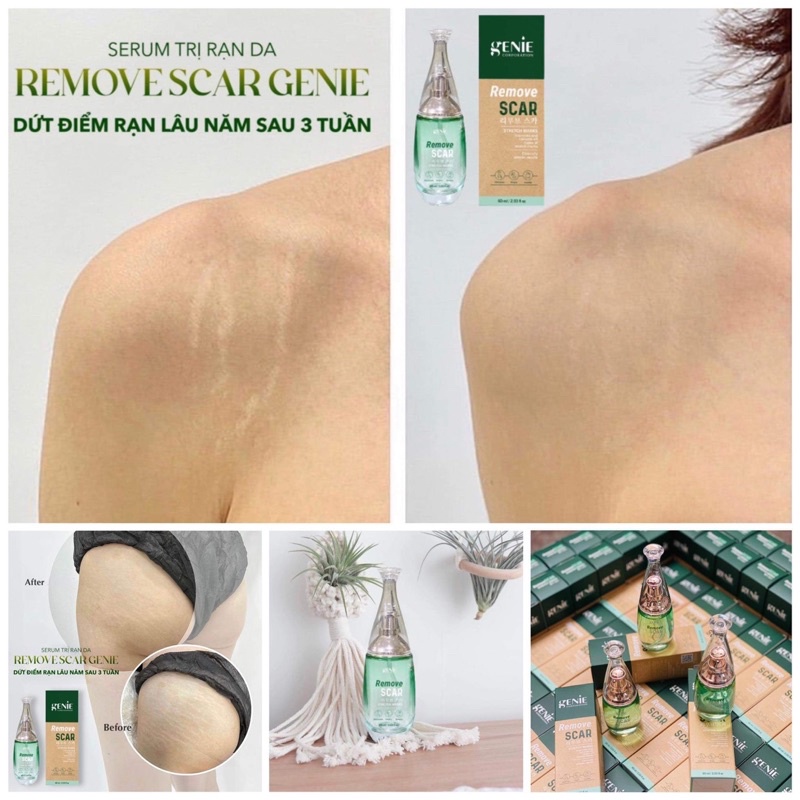 SERUM RẠN DA LÂU NĂM GENIE REMOVE SCAR | BigBuy360 - bigbuy360.vn