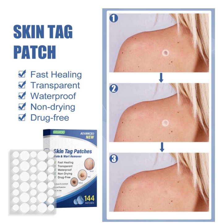 Miếng dán mụn SKIN TAG PATCH,  giảm sưng mụn đầu đen, mụn ruồi, mụn cơm  tái tạo da tự nhiên 144 miếng dán - soleil shop