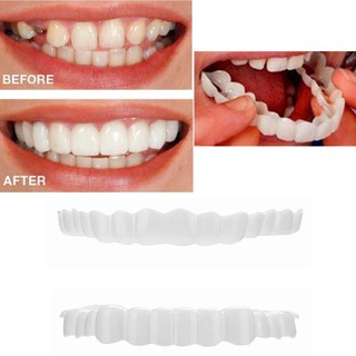 [BÁN CHẠY] niềng răng tại nhà snapon smile _(CÓ BẢO HÀNH)