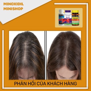Combo Mọc Râu Tóc Minoxidil Lỏng + Biotin + Folic (Tặng LCLT)