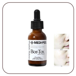 Medi-Peel - Tinh Chất Dưỡng Nâng Cơ, Chống Lão Hóa Medi-Peel Bor-Tox Peptide Ampoule 30ml