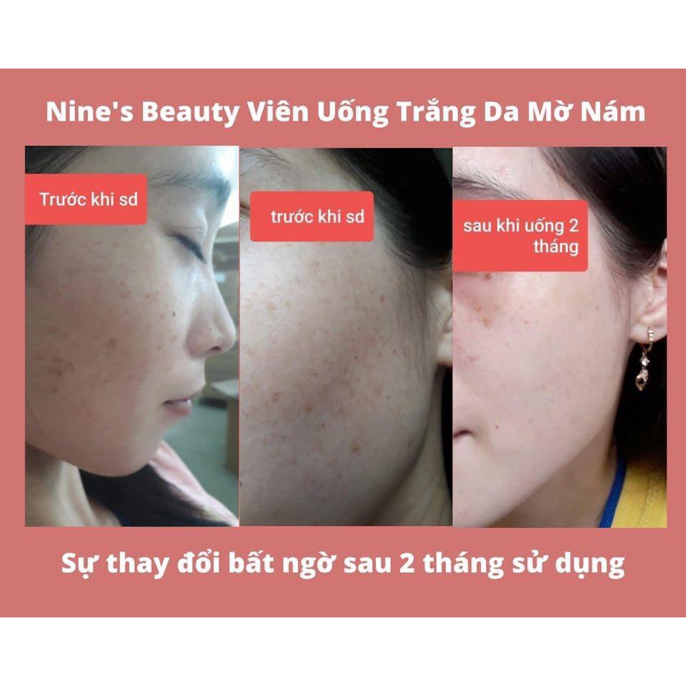 Viên uống trắng da Nine’s Beauty (30 viên) - Giúp làm sáng da, giảm thâm nám sạm, tàn nhang, lão hóa da