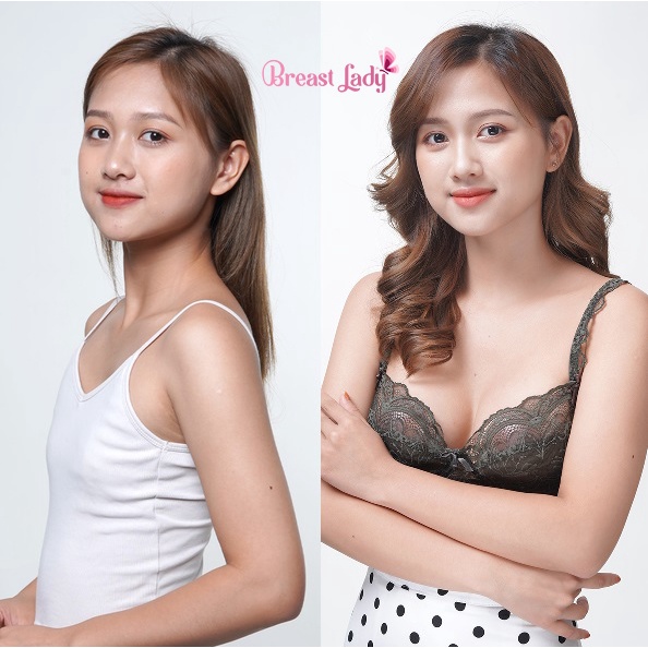 Viên Sủi Nở Ngực Breast Lady ❤️[ CHÍNH HÃNG ] ❤️ Tăng Size Vòng 1, Giảm Chạy Xệ, Căng Tròn Tự Nhiên.