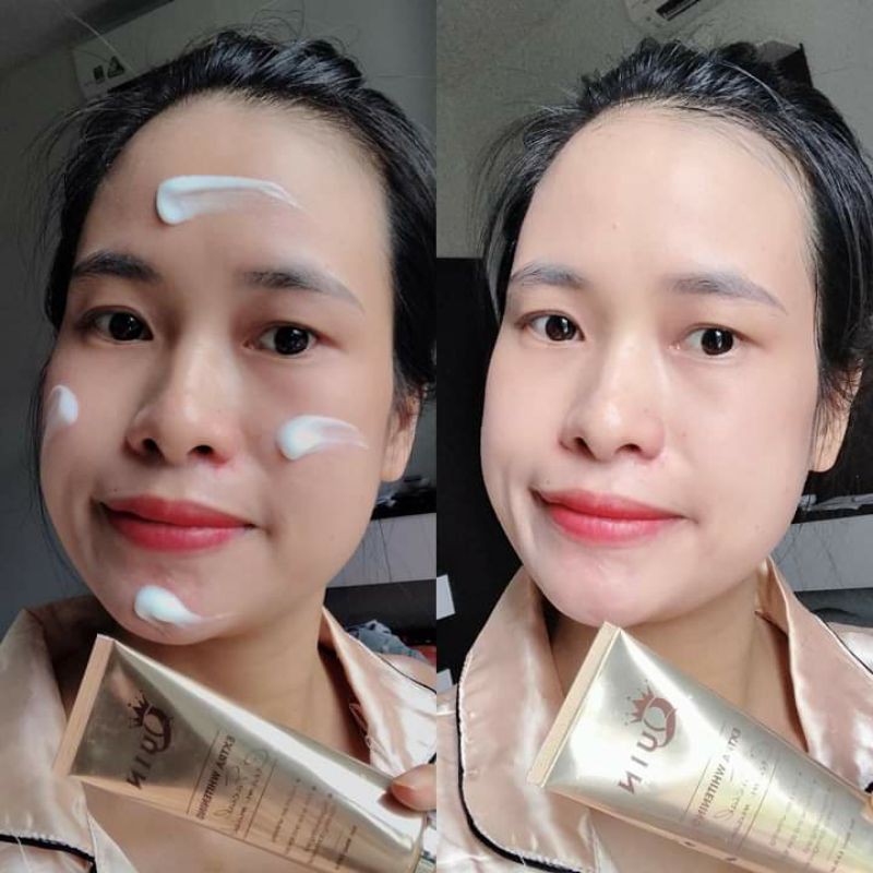 CẤY TRẮNG FACE QUIN TRẮNG HỒNG RẠNG RỠ 100% CHÍNH HÃNG | BigBuy360 - bigbuy360.vn