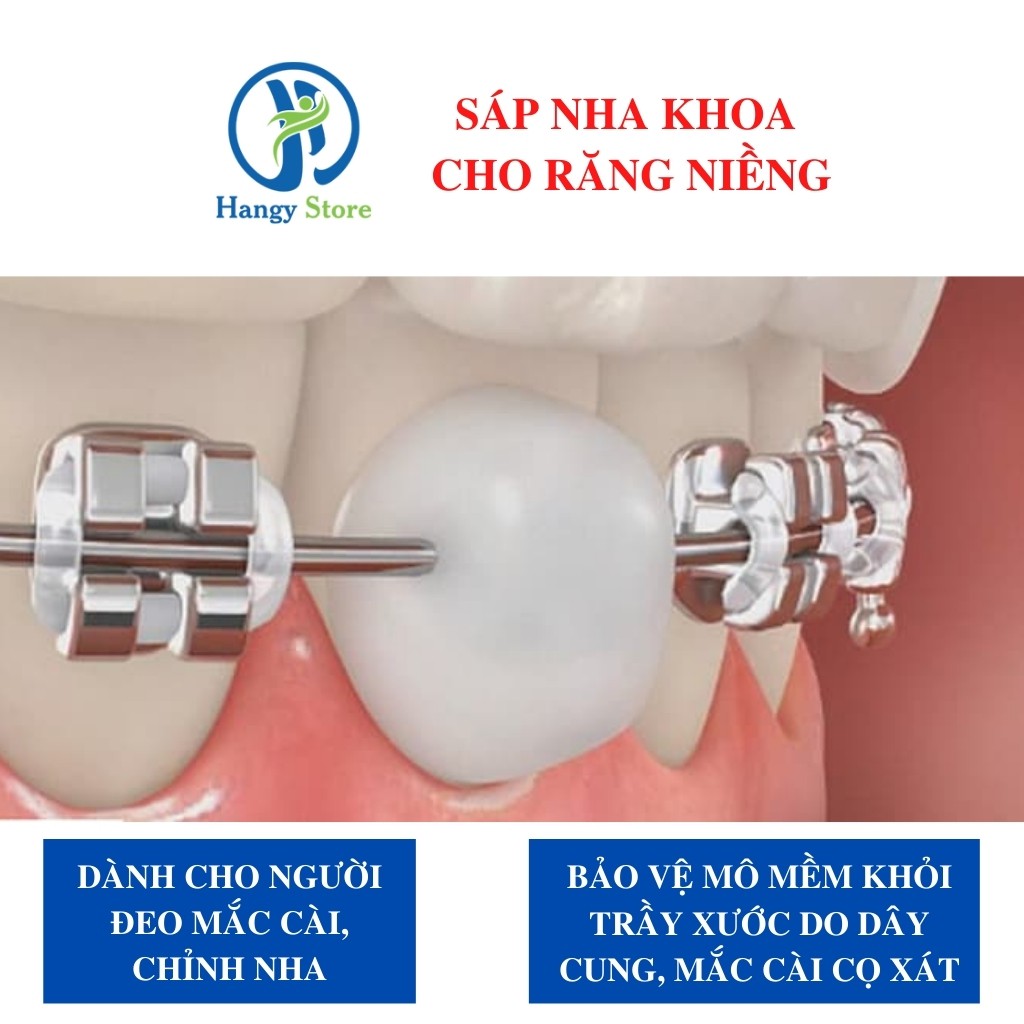 Sáp nha khoa dành cho người niềng răng chính hãng Diya
