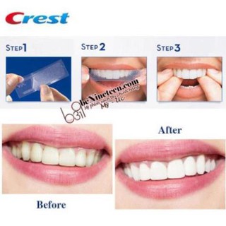 Miếng Dán Trắng Răng Crest 3D Whitestrips Glamorous White 28 Strips (28 miếng)