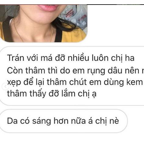 Kem thâm handmade Sunday Beauty