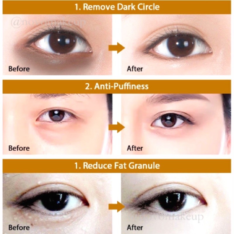 Mặt Nạ Mắt 𝑭𝒓𝒆𝒆𝒔𝒉𝒊𝒑 Mask Mắt Tinh Chất Collagen Vàng Hàn Quốc