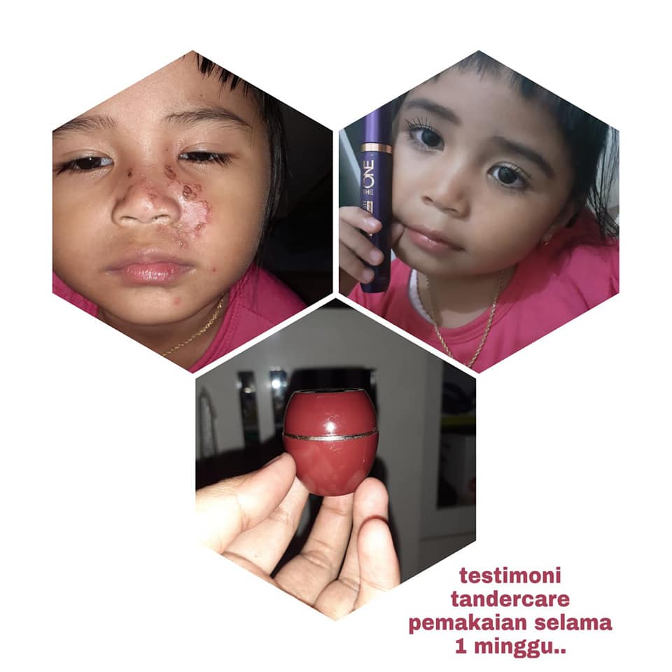 Sáp ong dưỡng da đa năng Tender Care Protecting Balm