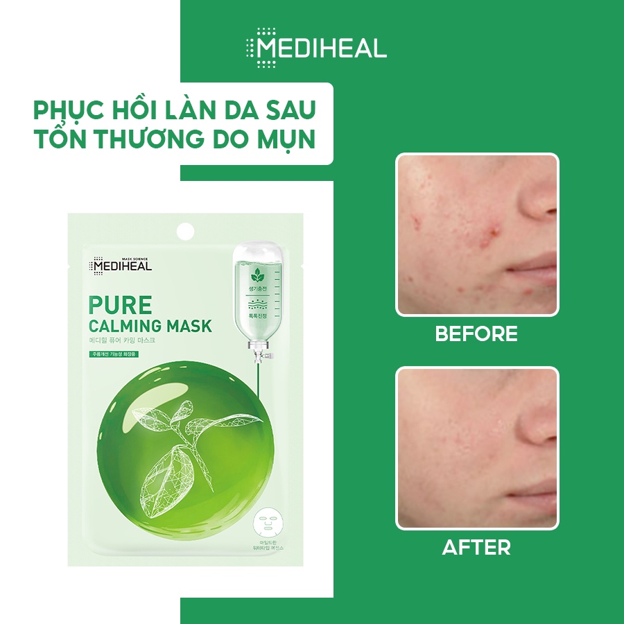 [Nhập mã COSMH22 giảm 8%] Mặt Nạ Dịu Da Se Khít Lỗ Chân Lông Mediheal Pure Calming Mask 20ml [K70]