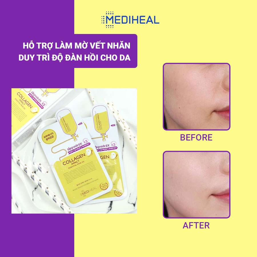 Mặt Nạ Collagen Ngăn Ngừa Lão Hóa Da Mediheal Collagen Impact Essential Mask EX 24ml [K3]