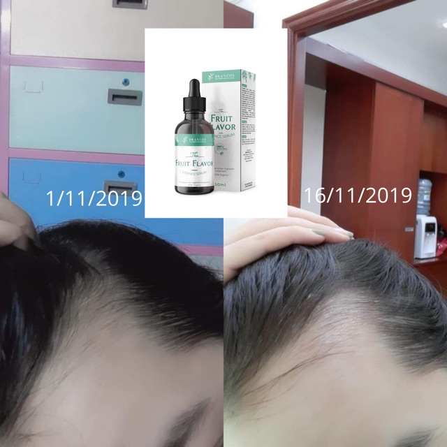 🍊[Phiên bản nâng cấp] FRUIT FLAVOR ESSENCE SERUM SERUM DƯỠNG TÓC - KÍCH MỌC BRANCOS🍏