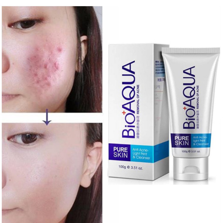 Sữa rửa mặt cho da mụn Bioaqua Removal Of ACNE BRA1