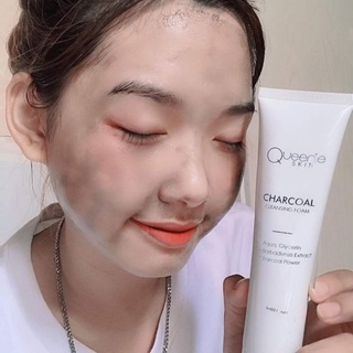SỮA RỬA MẶT THAN HOẠT TÍNH