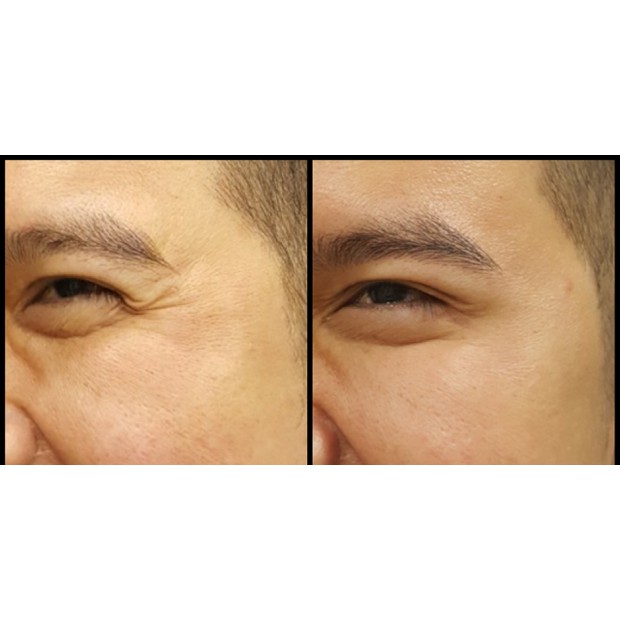 Combo gói sample dùng thử Kem Dưỡng Mắt Chống Lão Hóa Giảm Nhăn Ohui Age Recovery Eye Cream/ công ty chính hãng