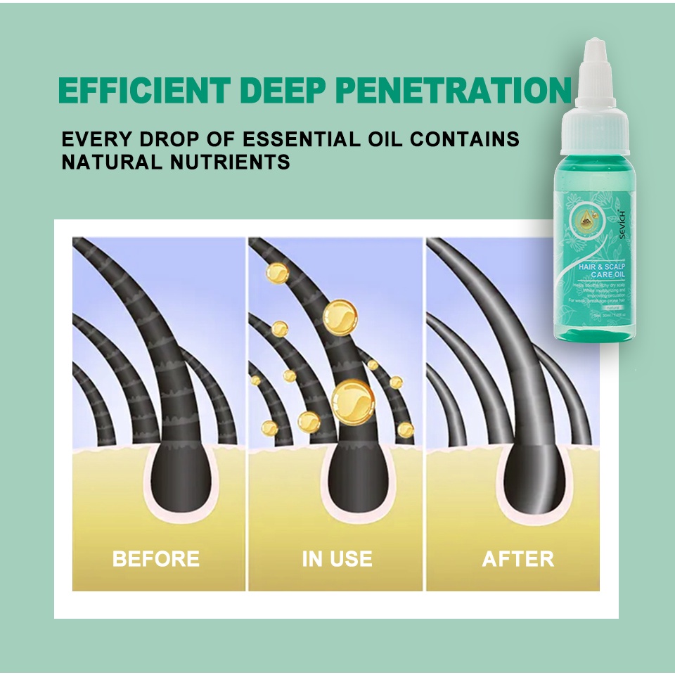 Tinh dầu SEVICH phục hồi tóc hư tổn hiệu quả 30ml