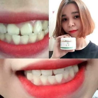 BỘT TRẮNG RĂNG TWHITE