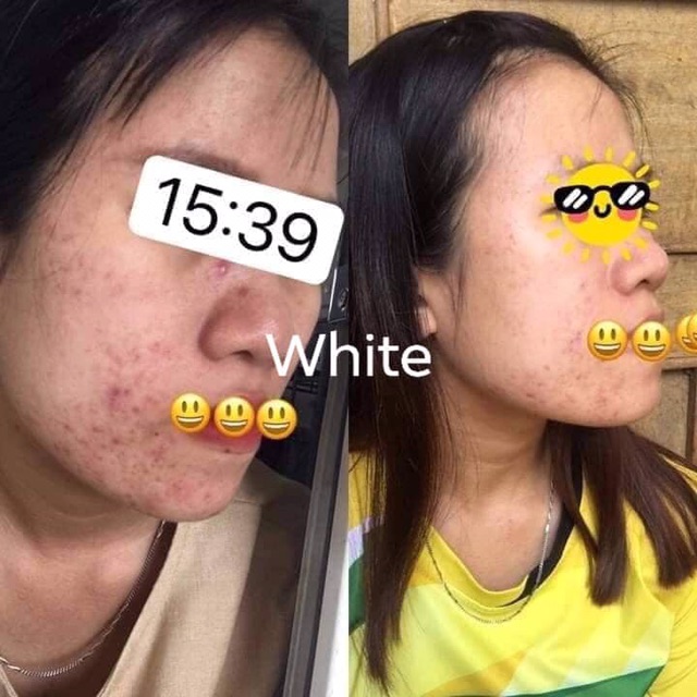Viên uống trắng da, mờ nám, trị mụn white+++ | BigBuy360 - bigbuy360.vn