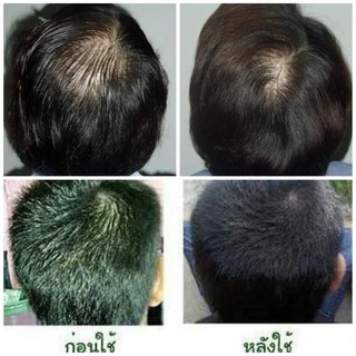 Combo 12 chai xịt mọc tóc mahaad Thái lan