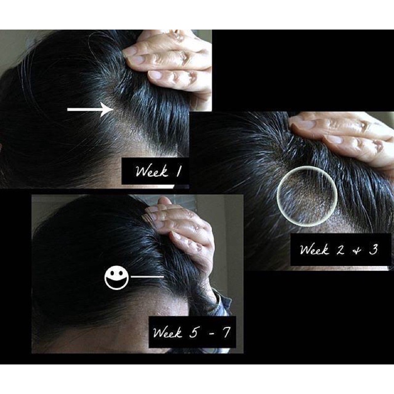 Tinh chất Copper Peptide  ✅ freeship ✅ giúp trẻ hoá da, phụ.c hồ.i da sau lăn kim