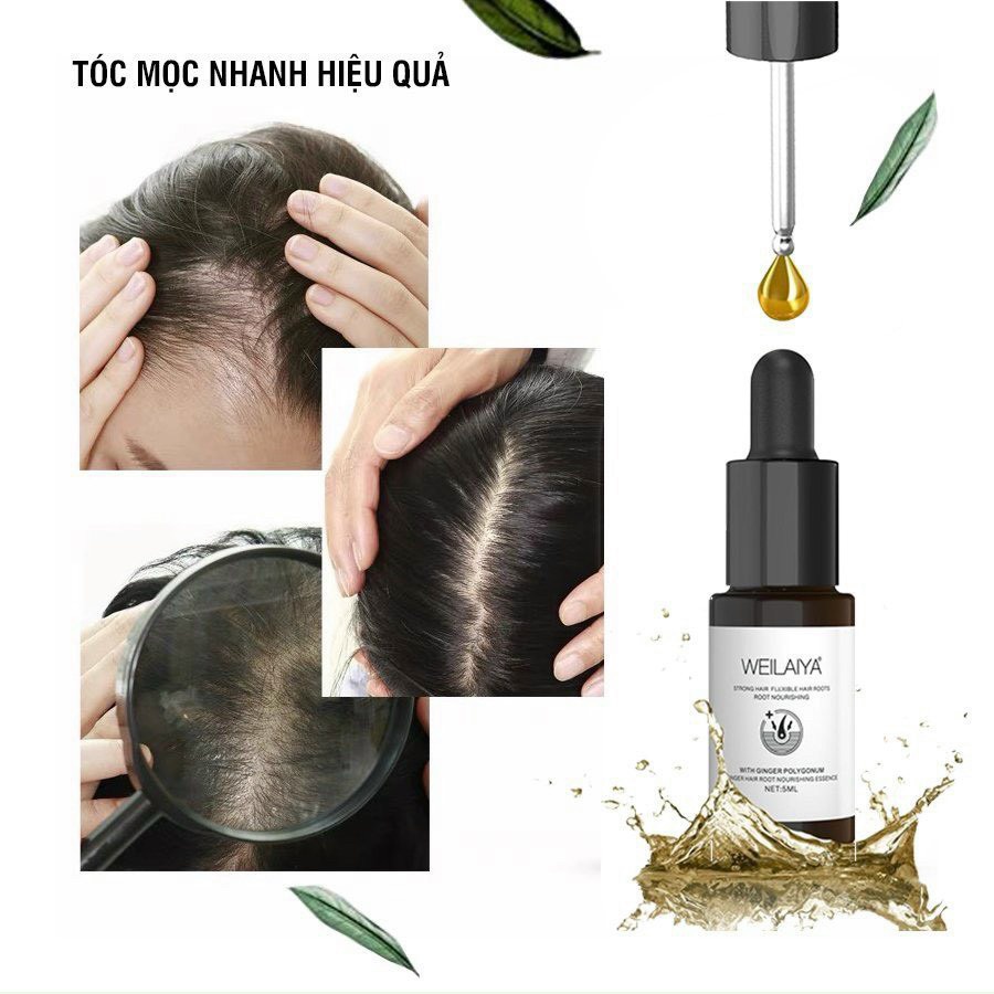 [SET 8 LỌ] Huyết Thanh Weilaiya Ngăn Ngừa Rụng Tóc, Kích Thích Tóc Mọc Nhanh Đều
