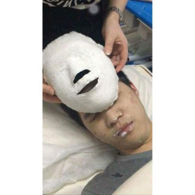 Mặt Nạ Cứng Dưỡng Da Handmade - Nâng cơ, Xẹp Sưng Viêm Sau Nặn Mụn
