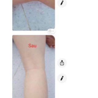 Chai lăn đuổi muỗi