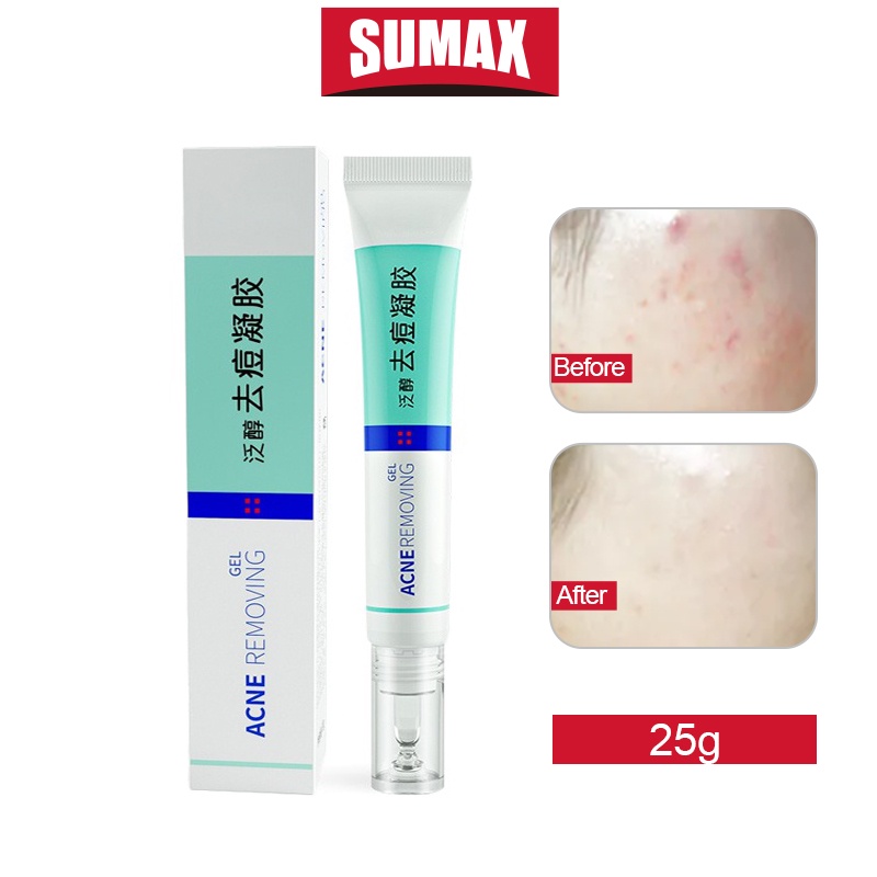 Kem cải thiện tình trạng mụn SUMAX làm giảm mụn ẩn và vết thâm 25g hiệu quả